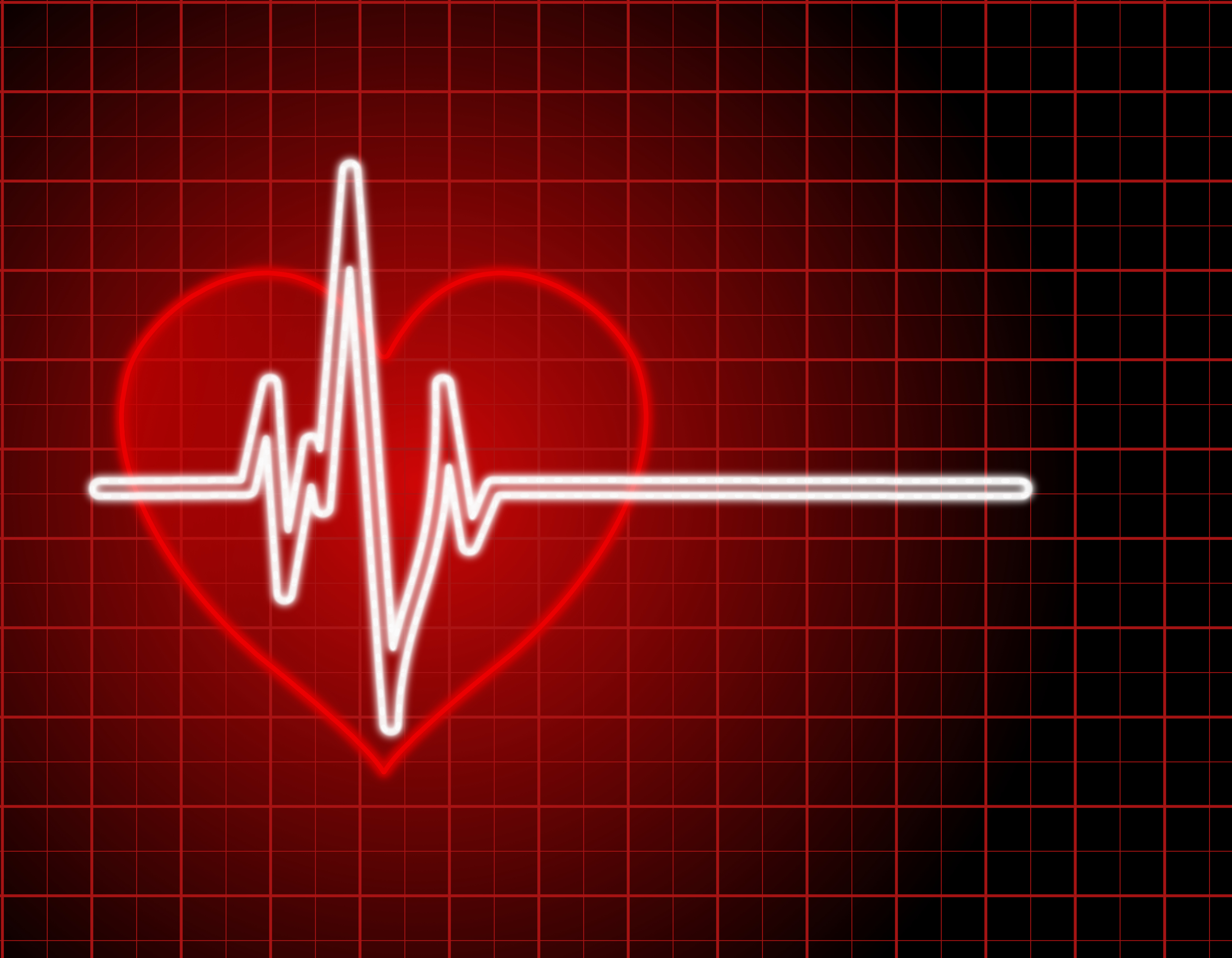 Кардиограмма остановки сердца
